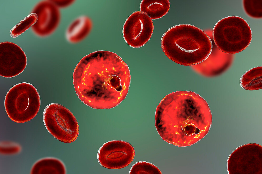 Plasmodium malariae inside red blood cell, illustration