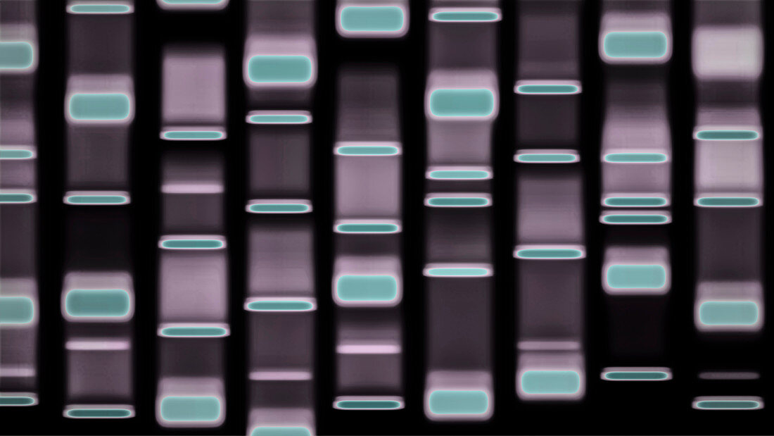 DNA autoradiograph, illustration