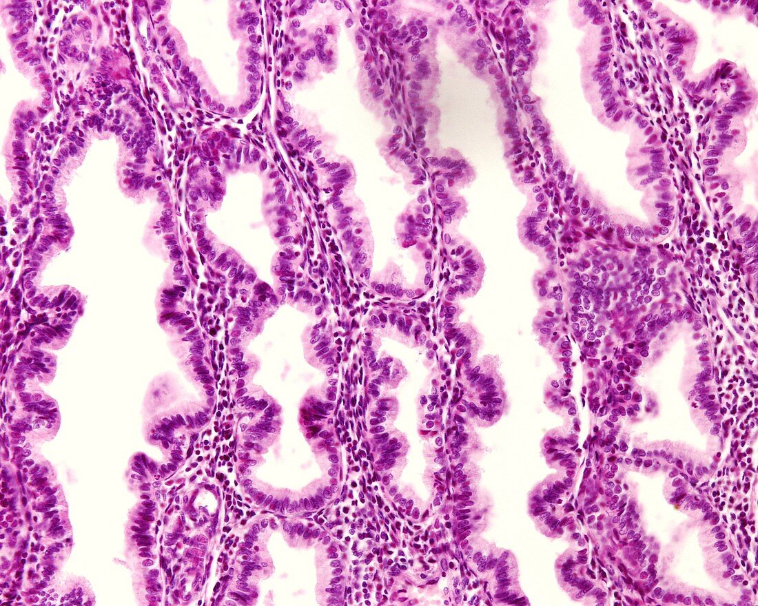 Endometrial glands in secretory phase,light micrograph