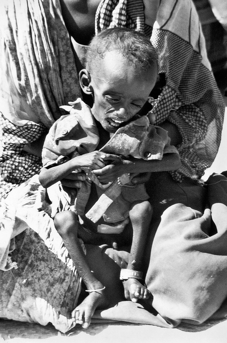 Ethiopian child refugee in Sudan