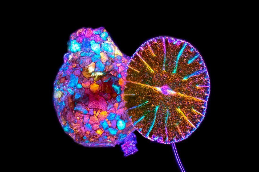 Shelled amoeba with micrasterias, light micrograph