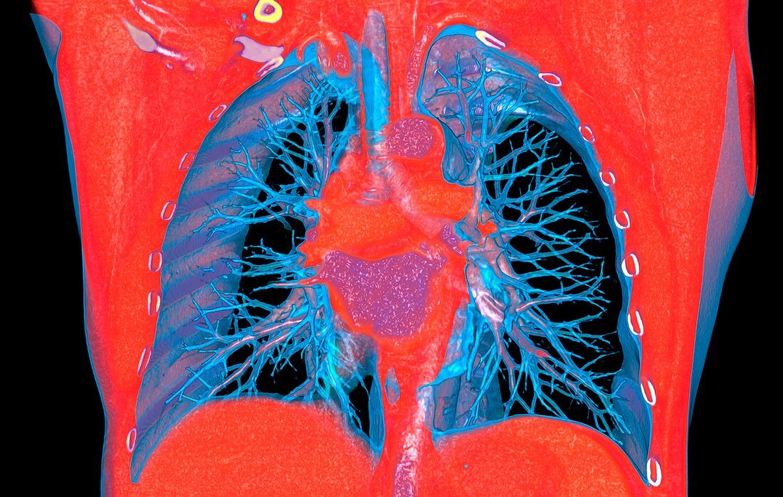 Heart and lungs,3D CT scan
