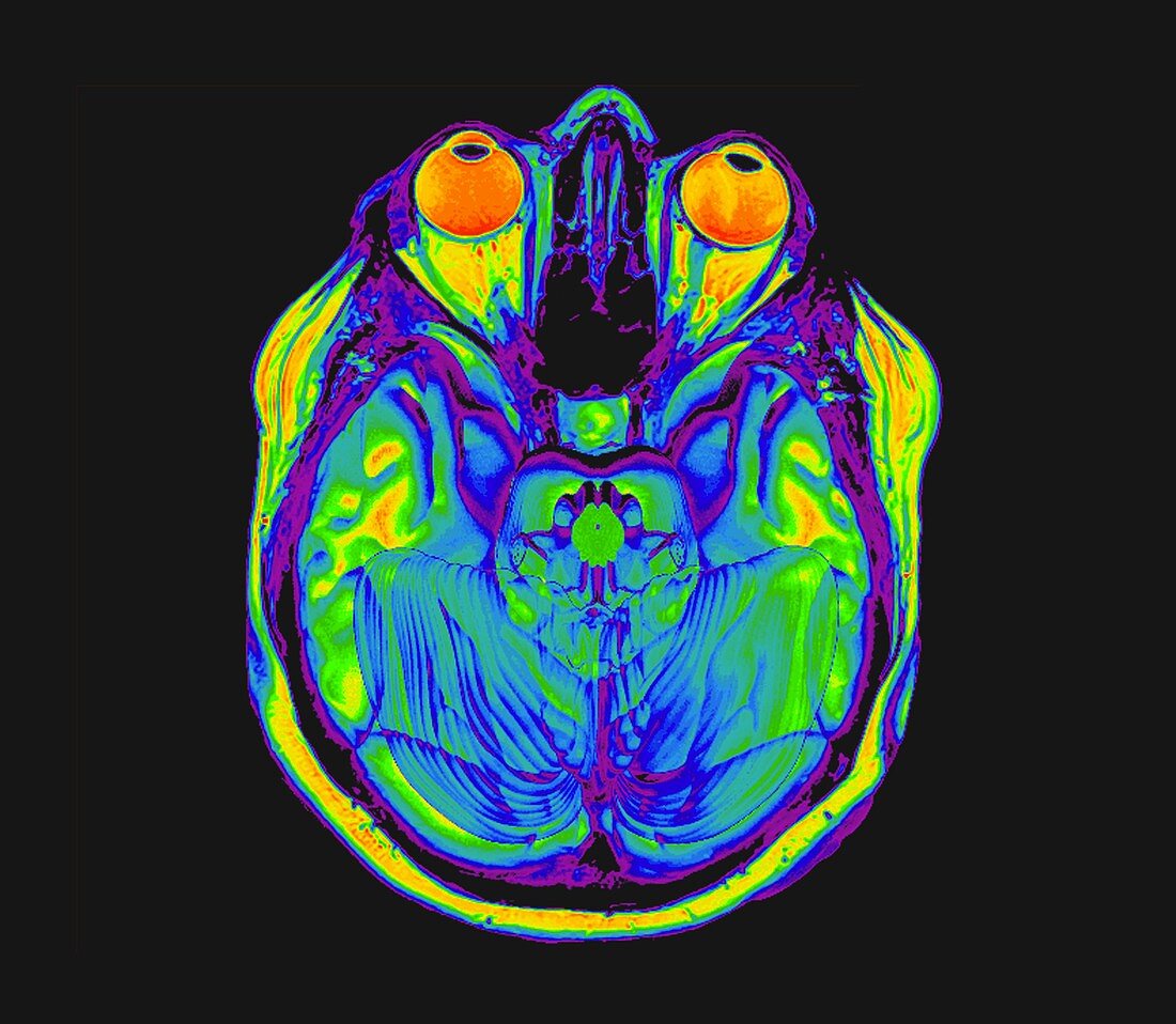 Human eyes and brain,MRI scan