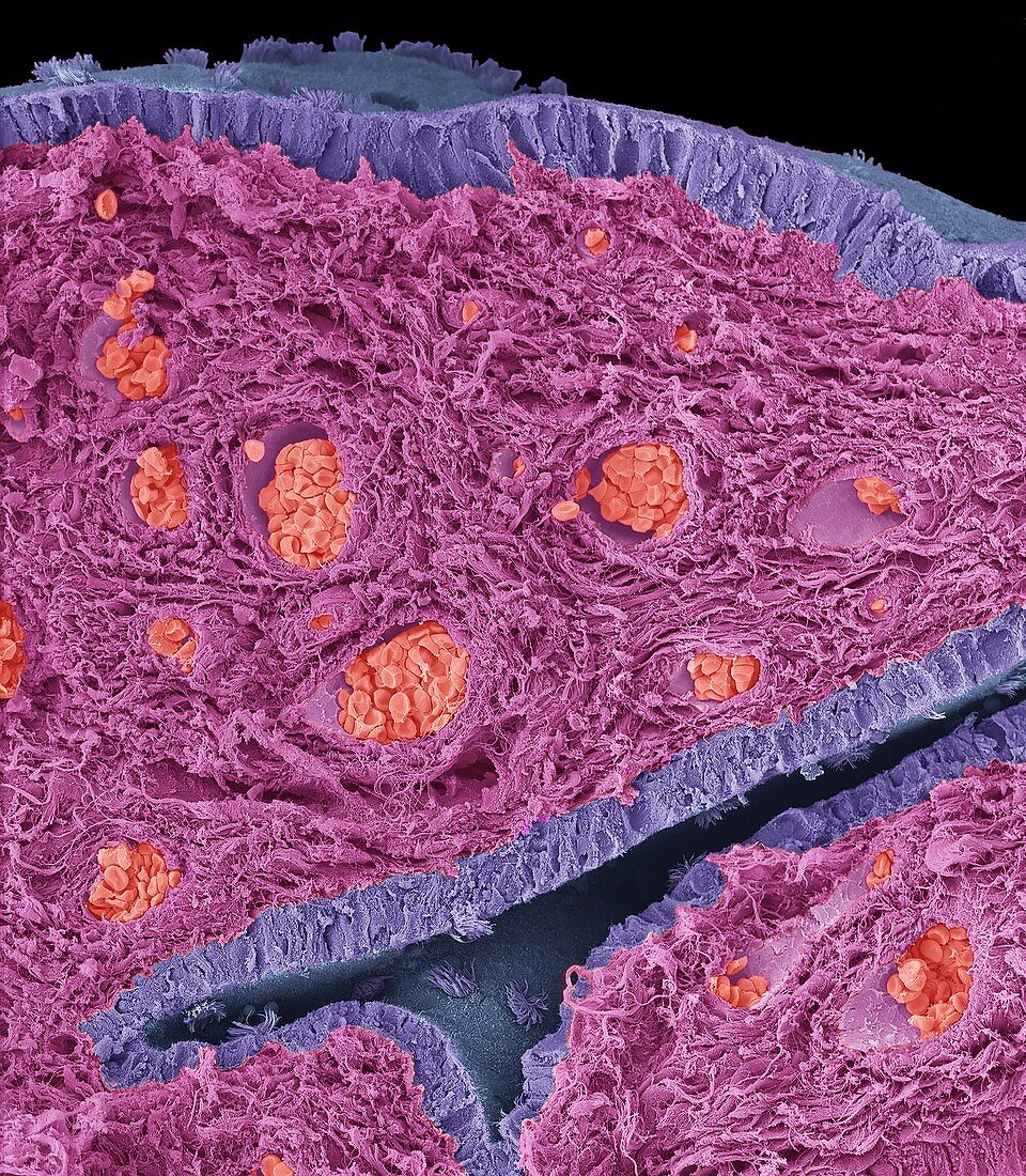 Fimbriae of a fallopian tube,SEM