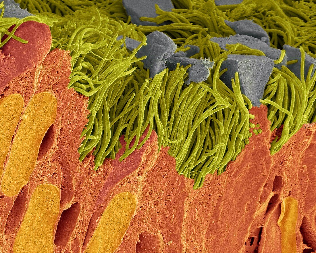 Bronchiole lining,SEM