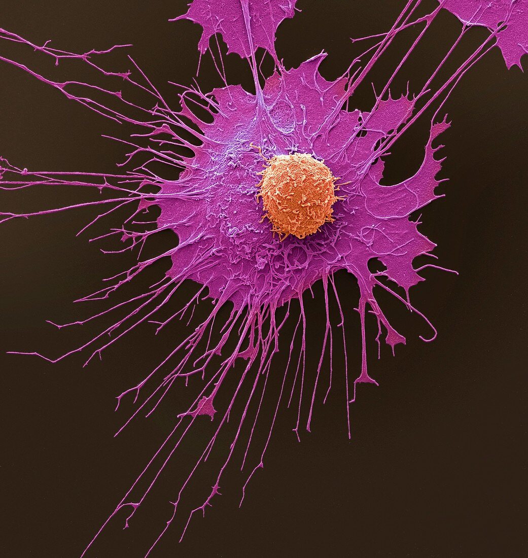 CAR T-cell therapy,SEM