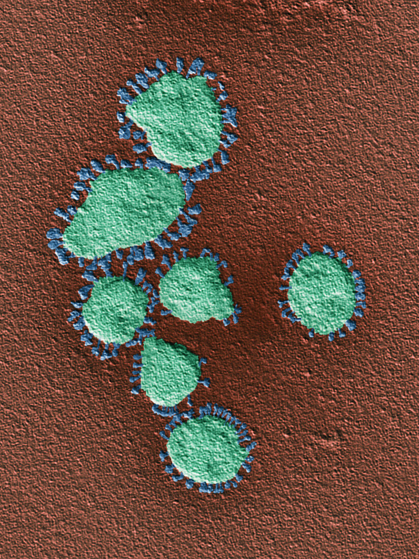 Coronavirus particles,SEM