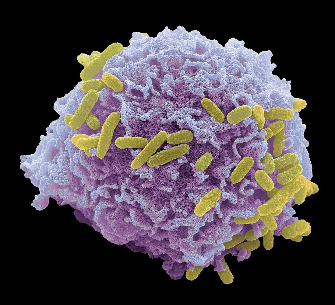Bacterial cell infection,SEM