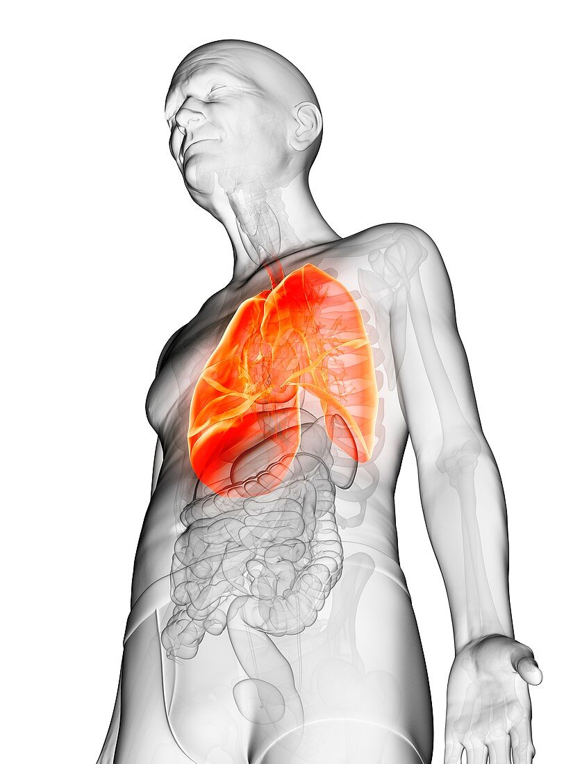 Illustration of an elderly man's lung