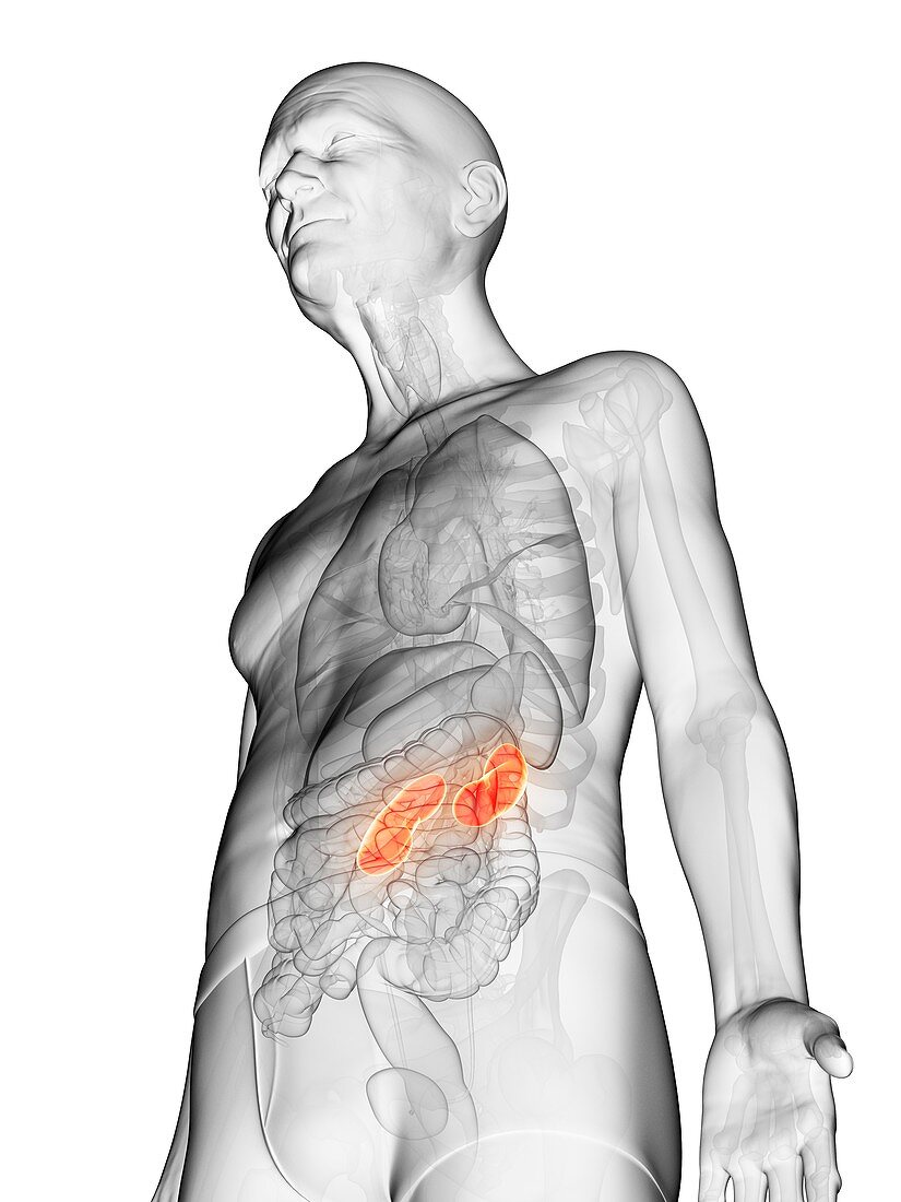 Illustration of an elderly man's kidney