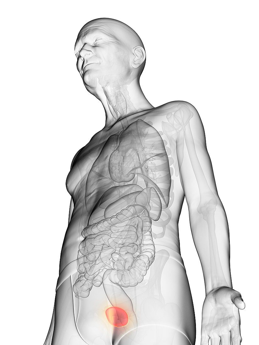 Illustration of an elderly man's bladder