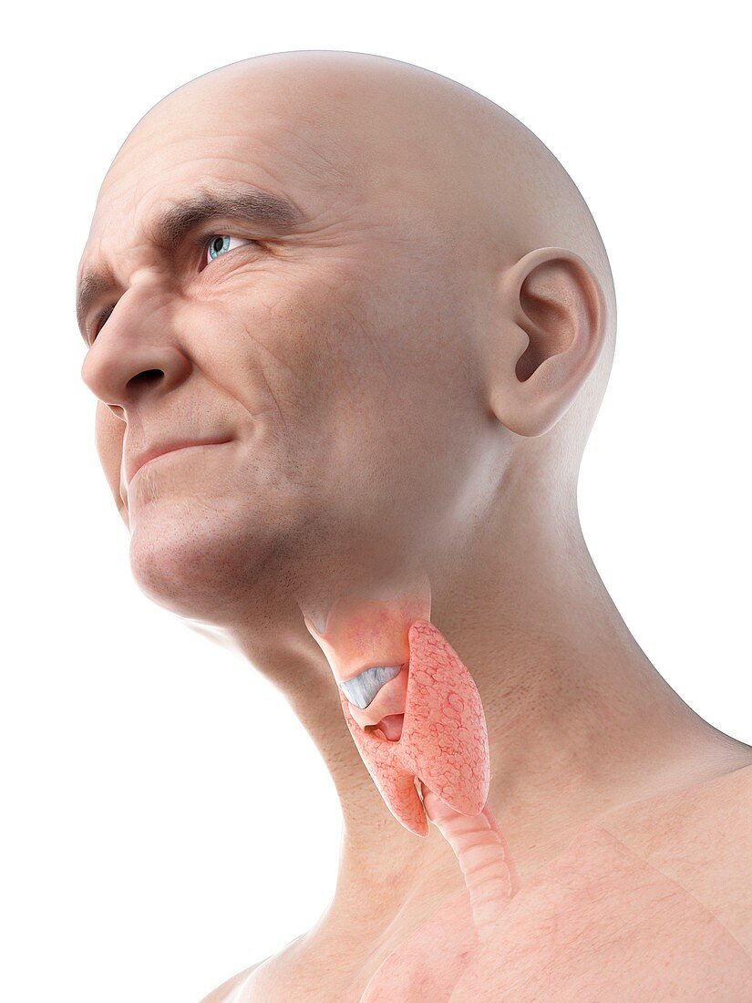 Illustration of an old man's thyroid