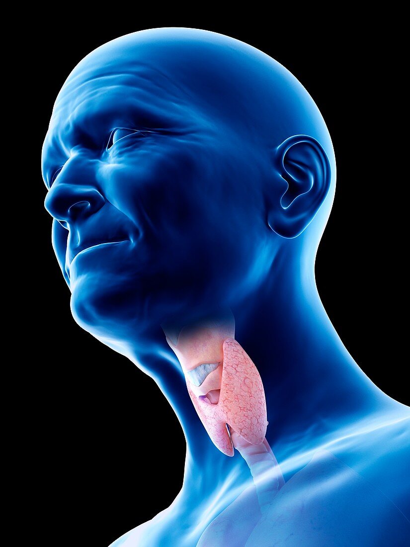 Illustration of an old man's thyroid