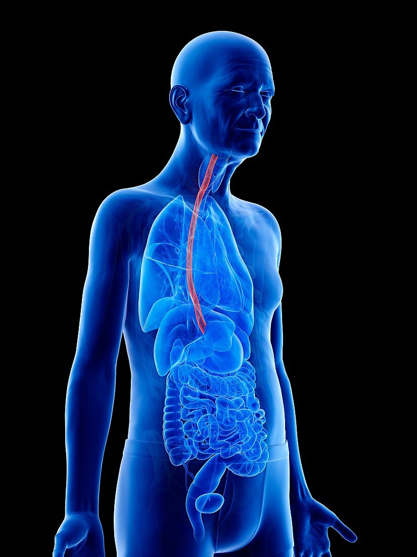 Illustration of an old man's esophagus