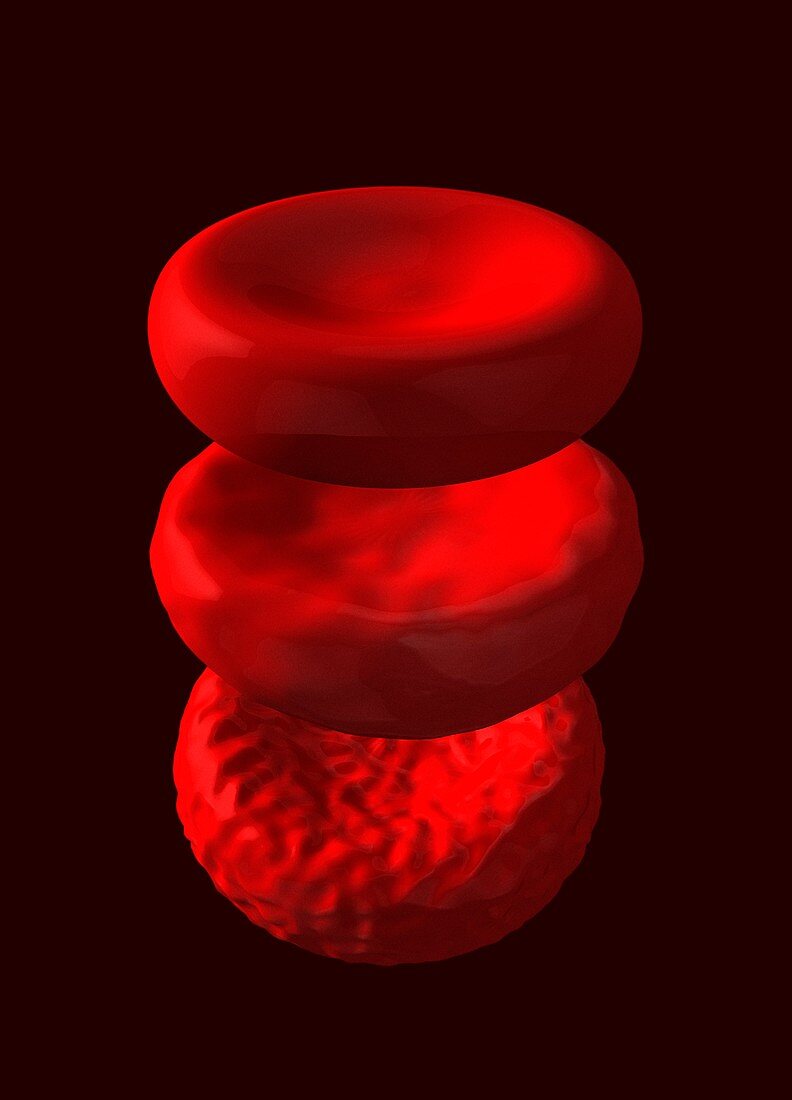 Dead,dying and healthy red blood cells,illustration