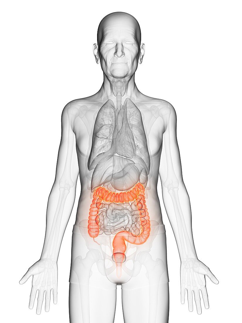 Illustration of an elderly man's colon