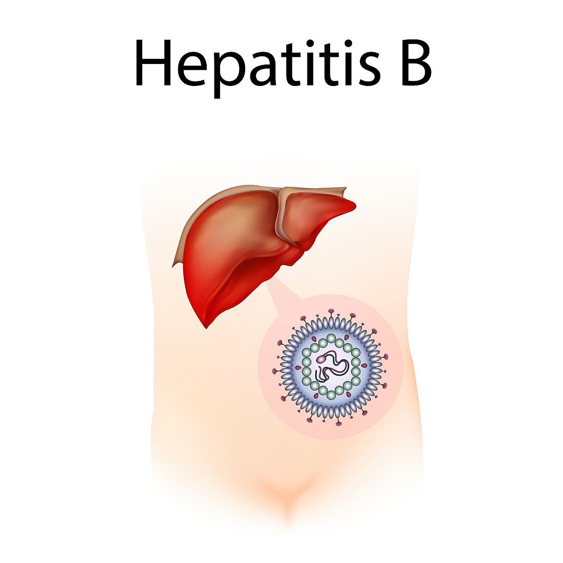 Hepatitis B,illustration