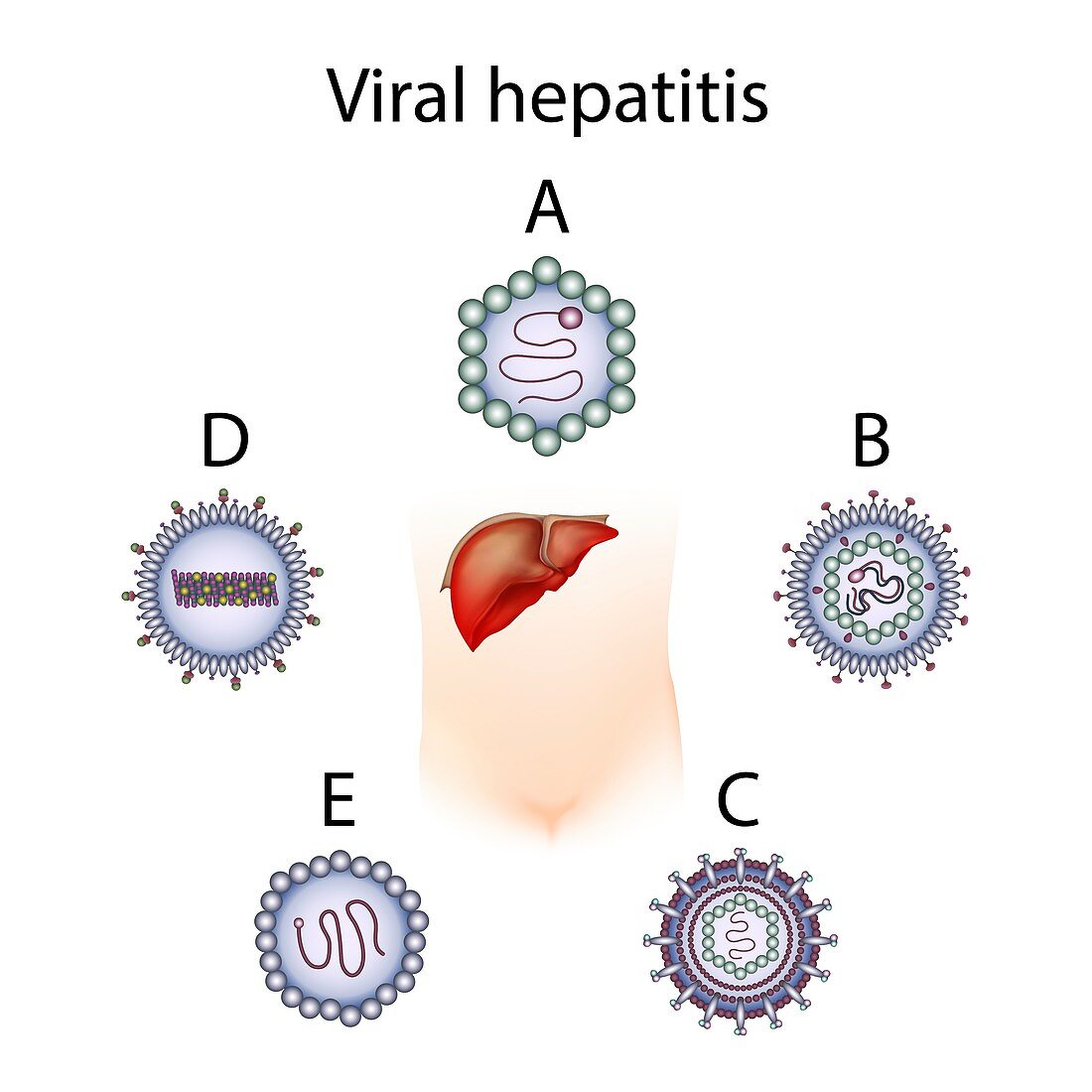 Hepatitis types A B C D E,illustration