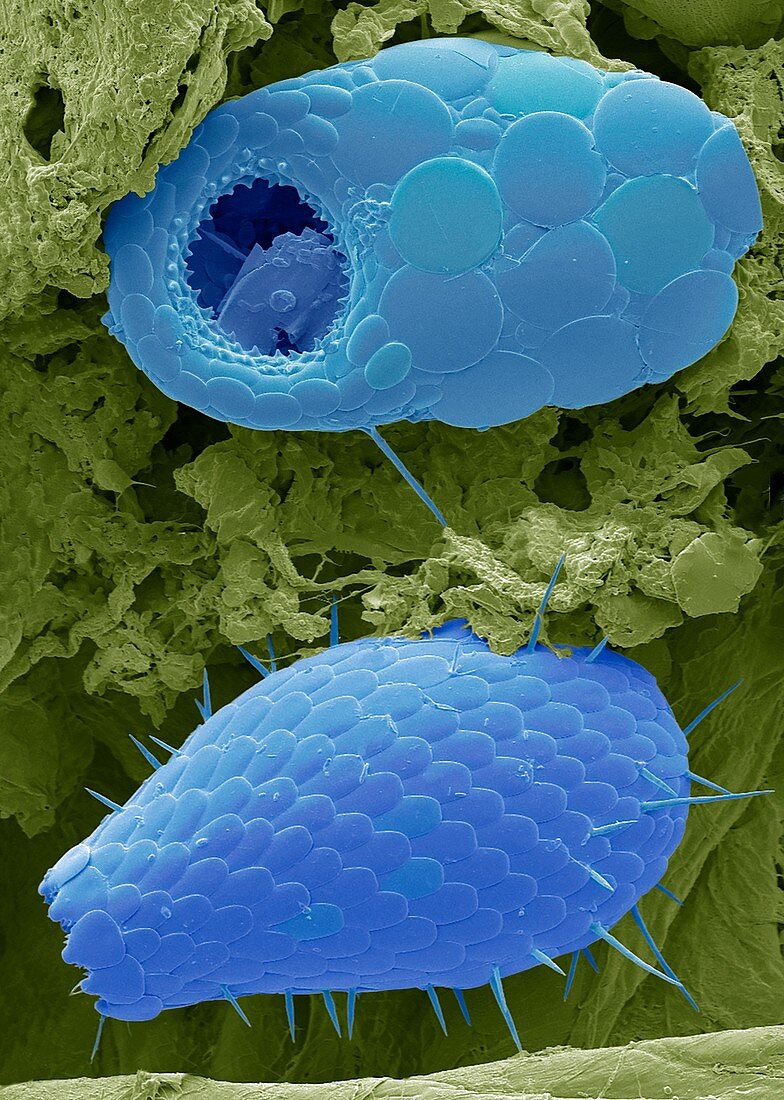 Shelled amoebae,SEM