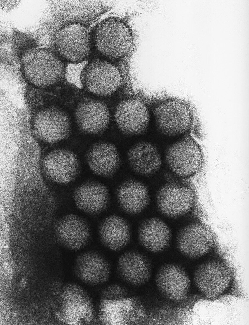 TEM of Adenovirus