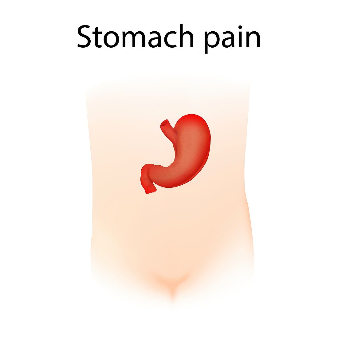 Stomach pain,illustration