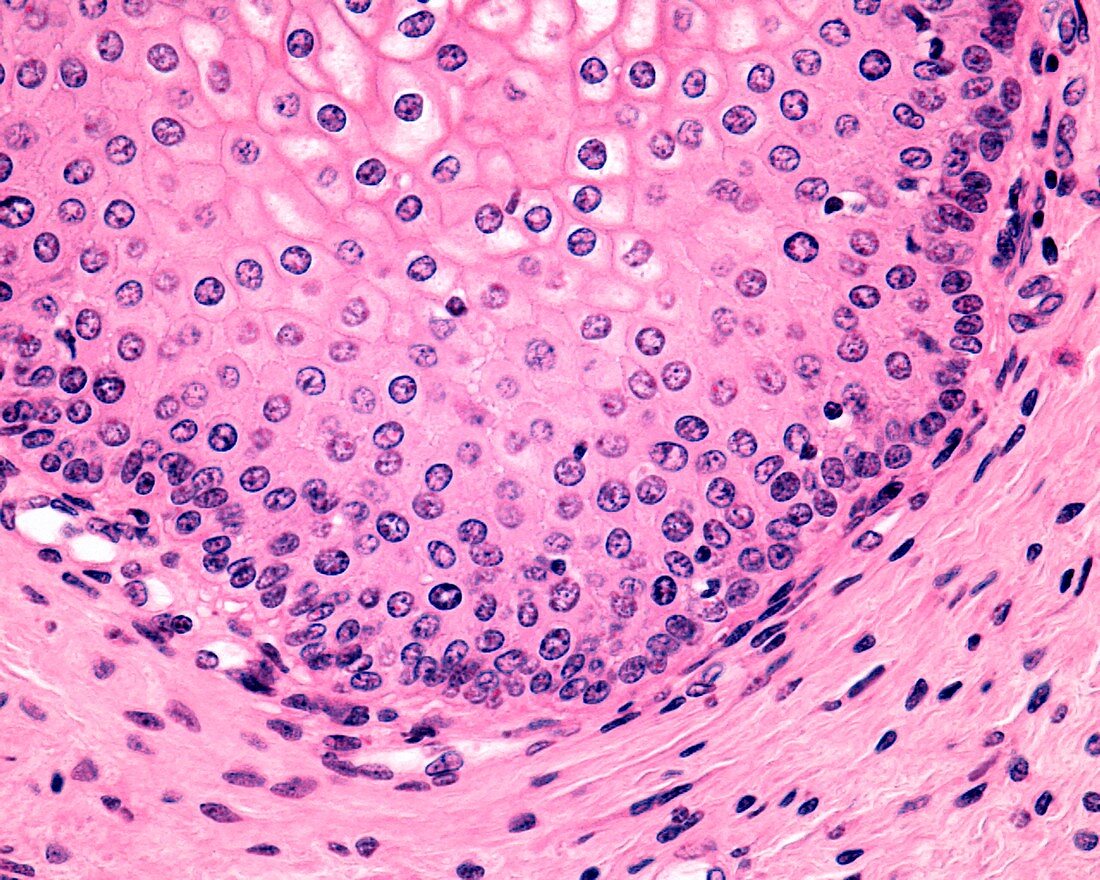 Vaginal epithelium, light micrograph