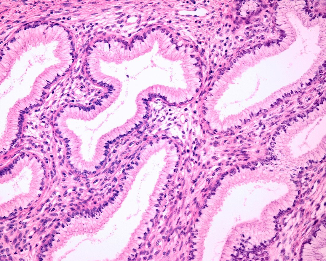 Endocervical glands, light micrograph