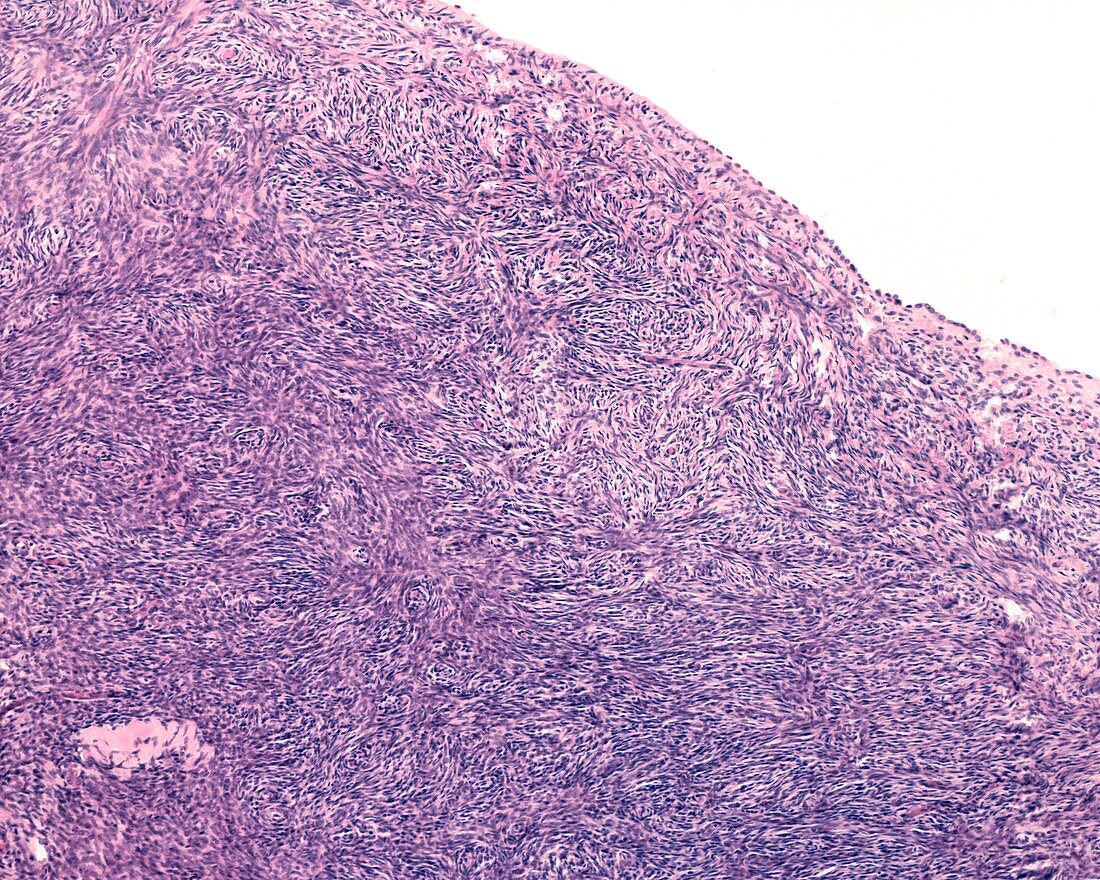 Ovarian stroma, light micrograph
