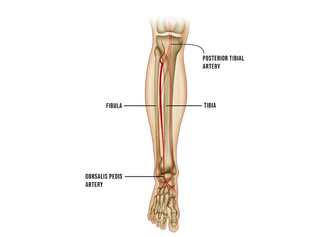 Leg artery cannulation sites, illustration