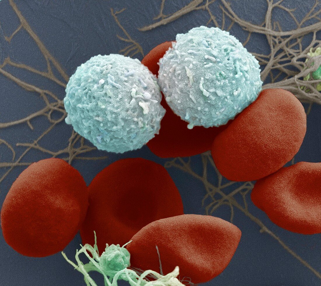 Red and white blood cells and platelets, SEM
