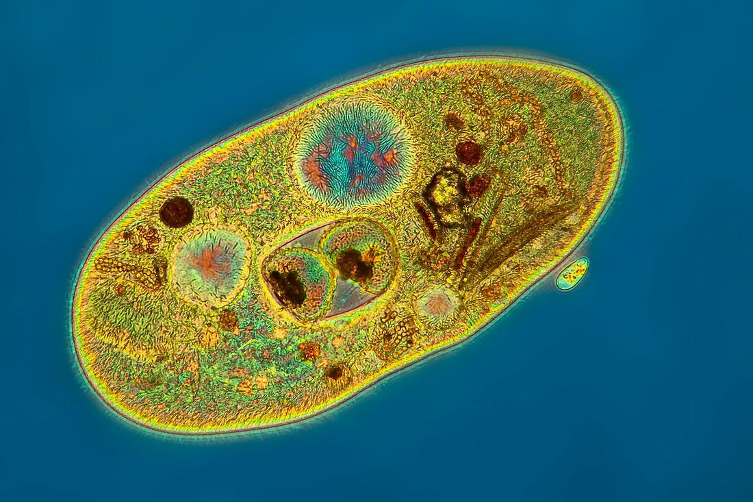 Frontonia sp. protist , light micrograph