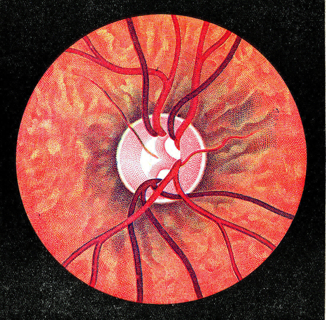 Fundus and optic disc of the eye, historical illustration