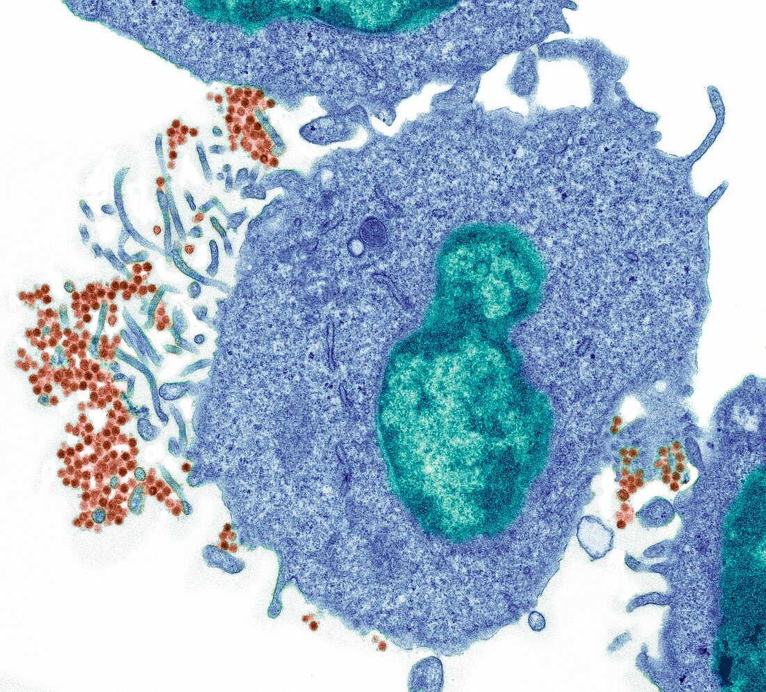 Epstein barr virus, TEM