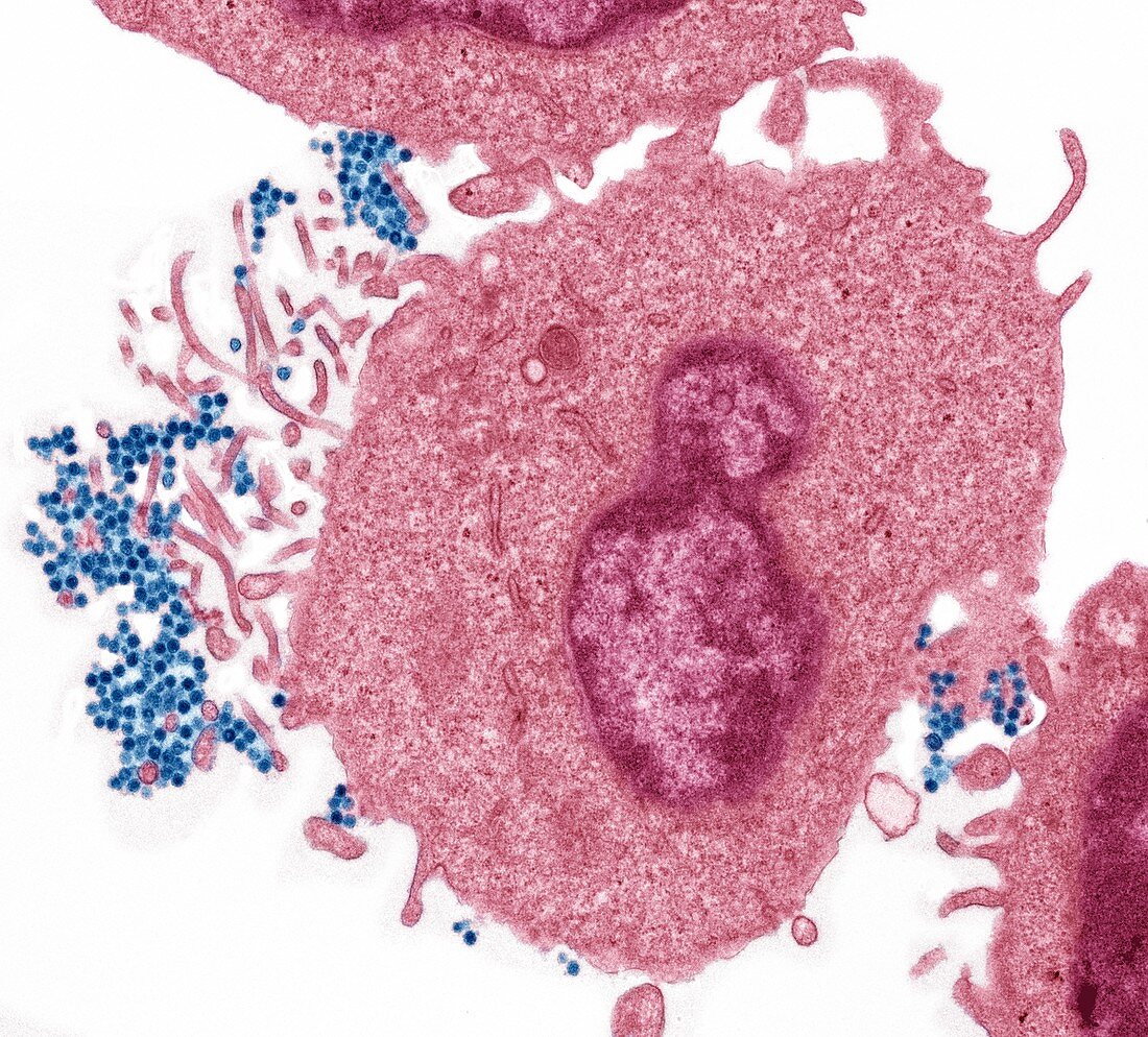 Epstein barr virus, TEM