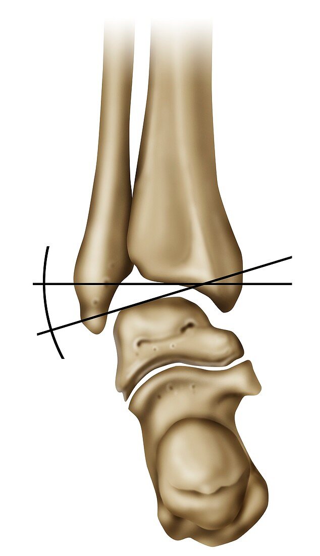 Ankle joint movement, illustration