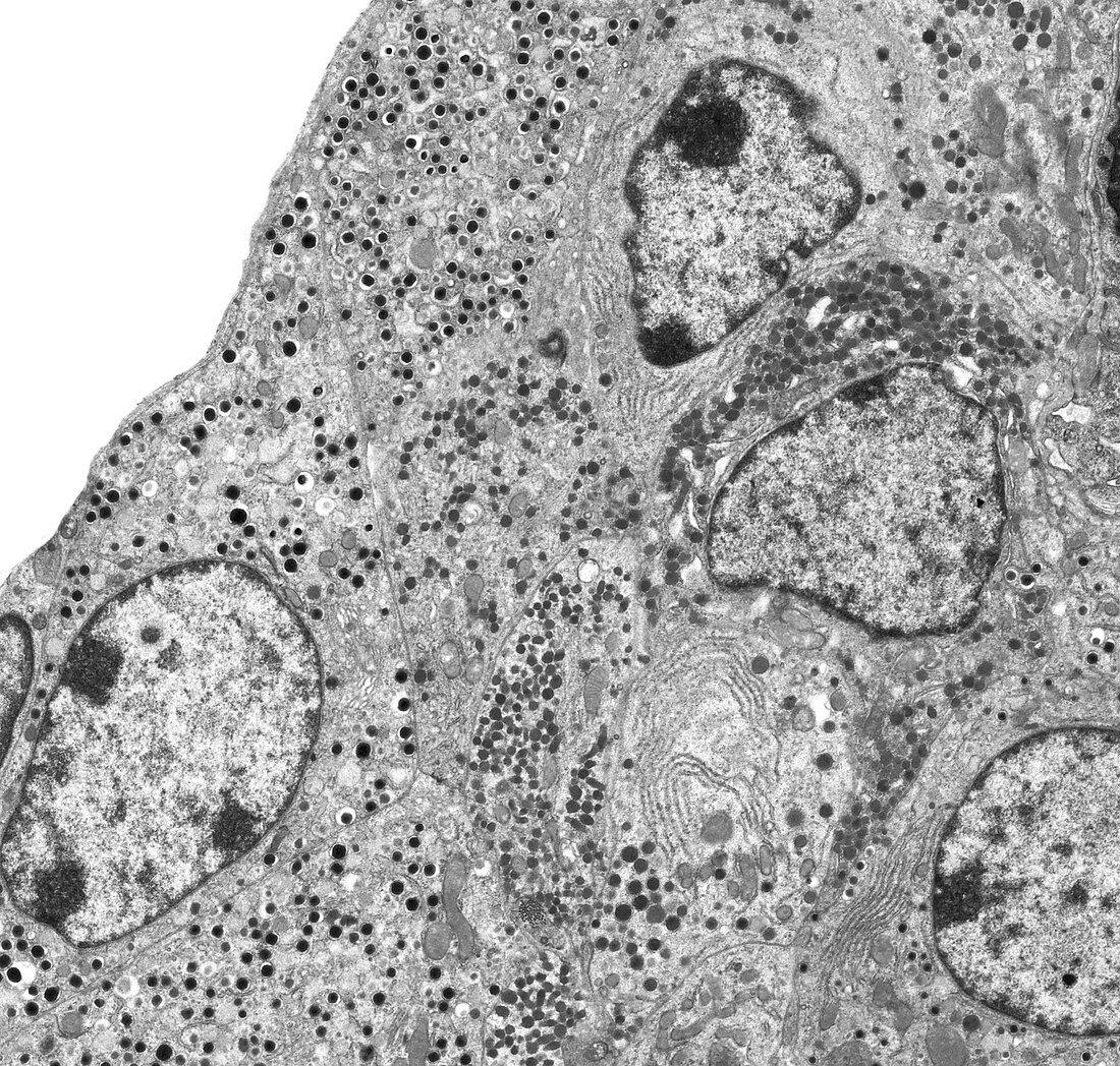 Pancreatic islet cells, TEM