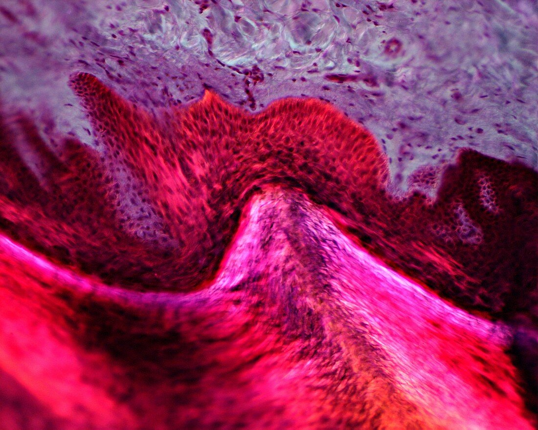 Human skin, light micrograph