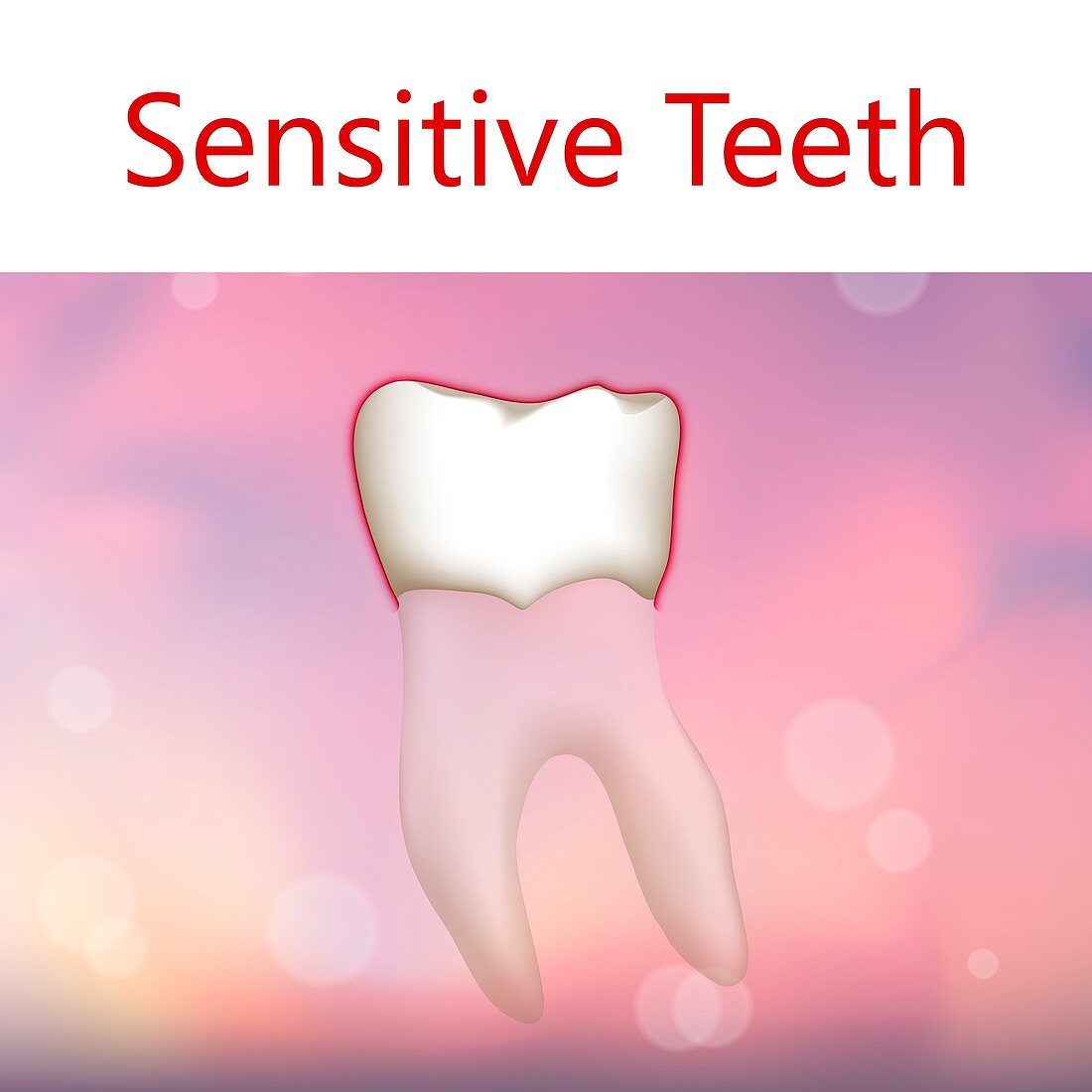 Sensitive tooth, illustration