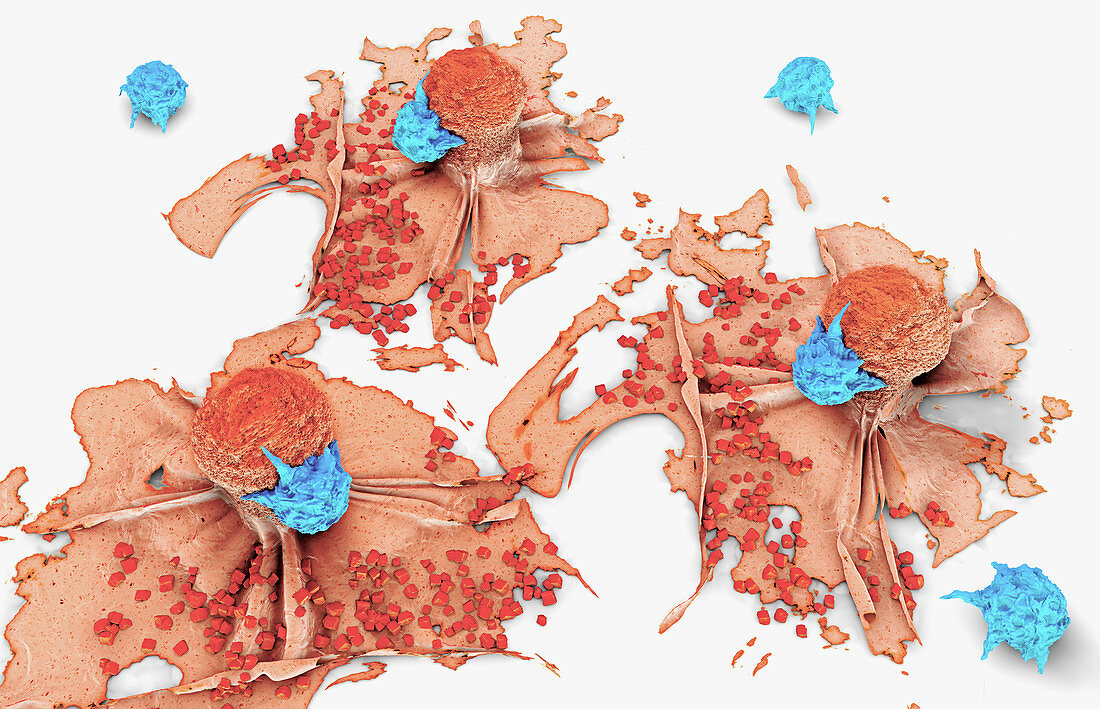 Lymphocytes attacking cancer cells, illustration