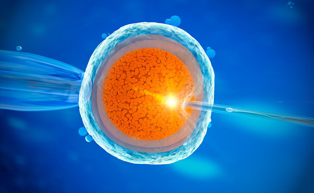 In vitro fertilization, illustration