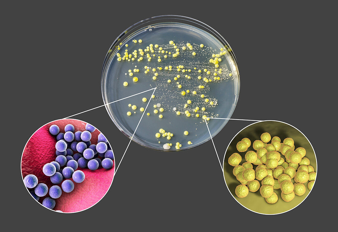 Bacterial culture grown from human skin, composite image