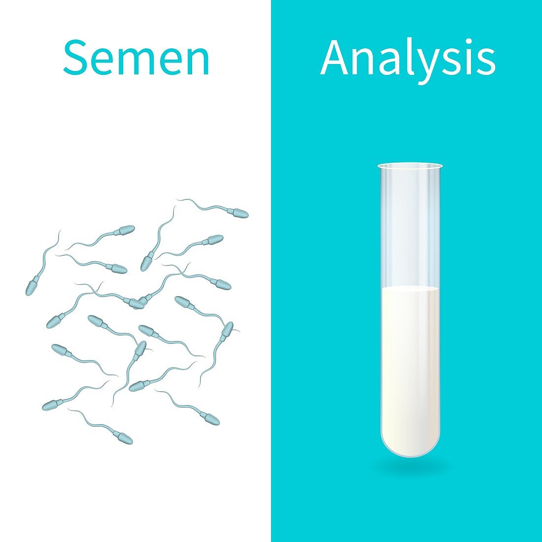 Semen analysis, illustration