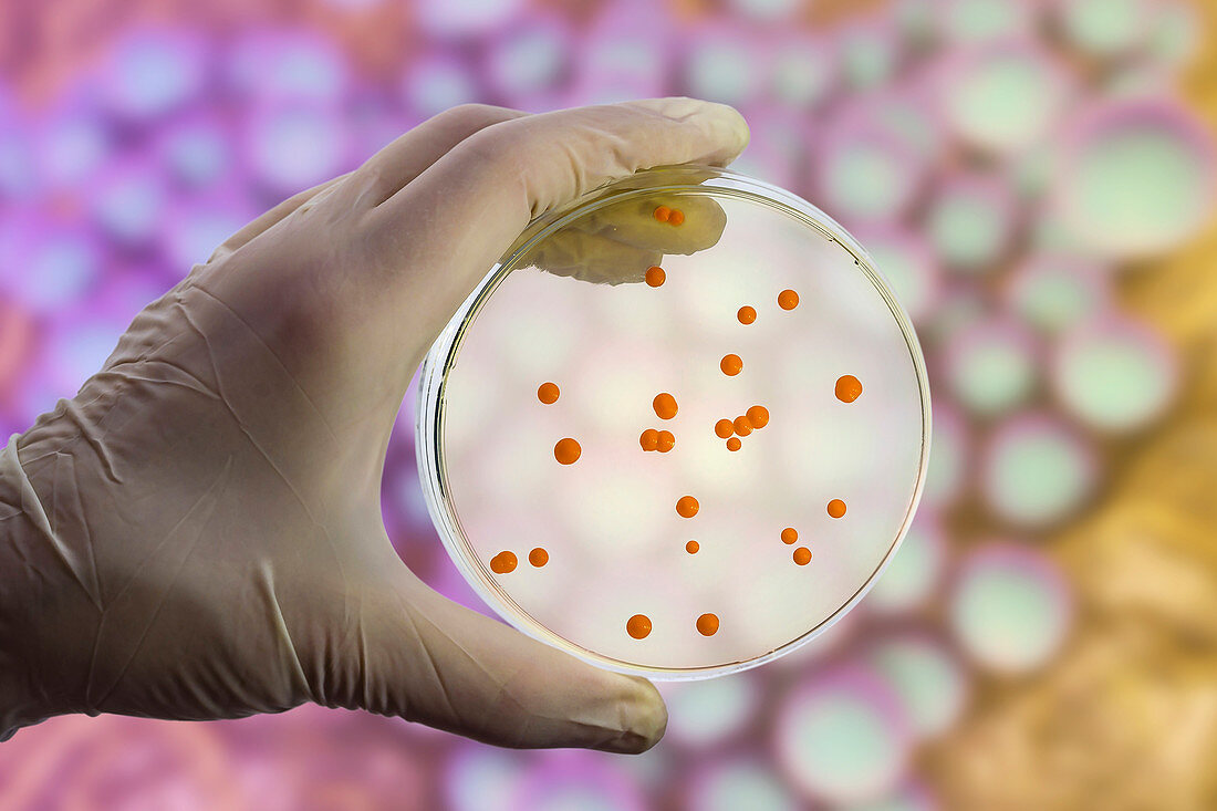 Bacterial and fungal cultures, composite image