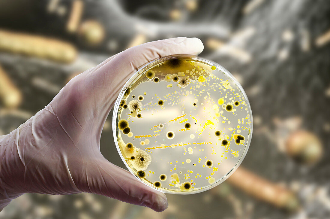 Bacterial and fungal cultures, composite image