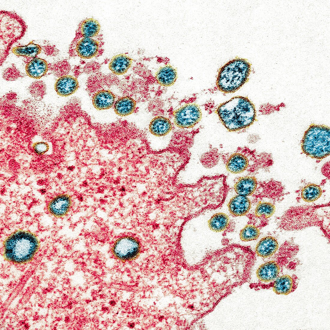 Covid-19 coronavirus, TEM