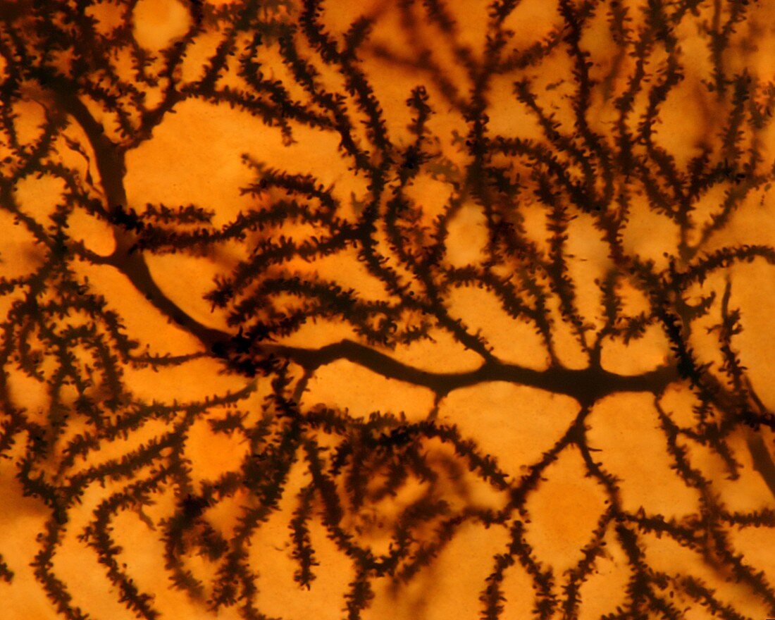 Purkinje dendrite spines, light micrograph