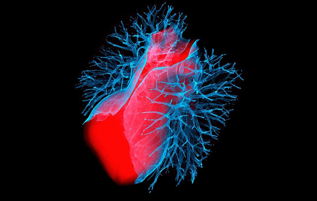Heart and lung airways, 3D CT scan