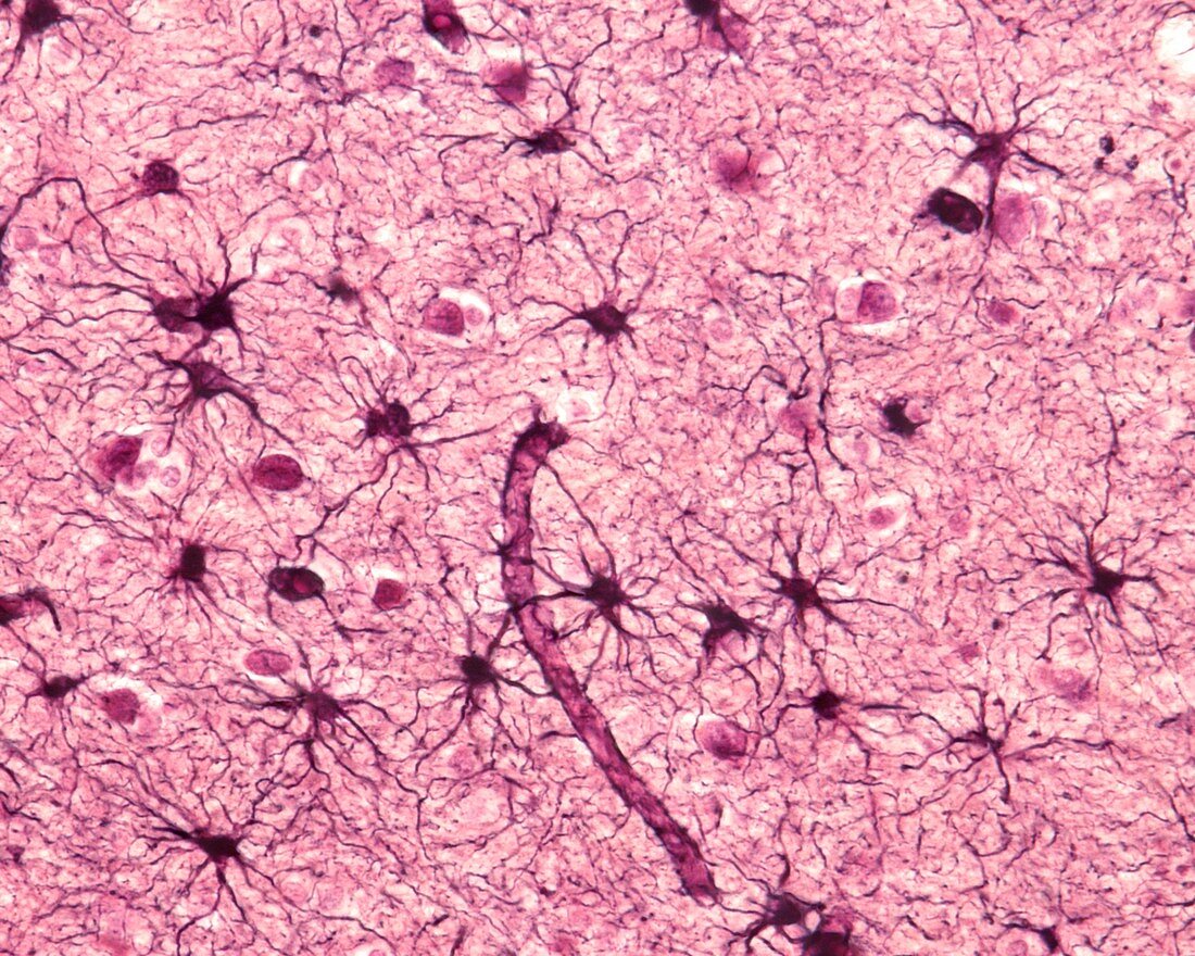 Astrocytes, light micrograph