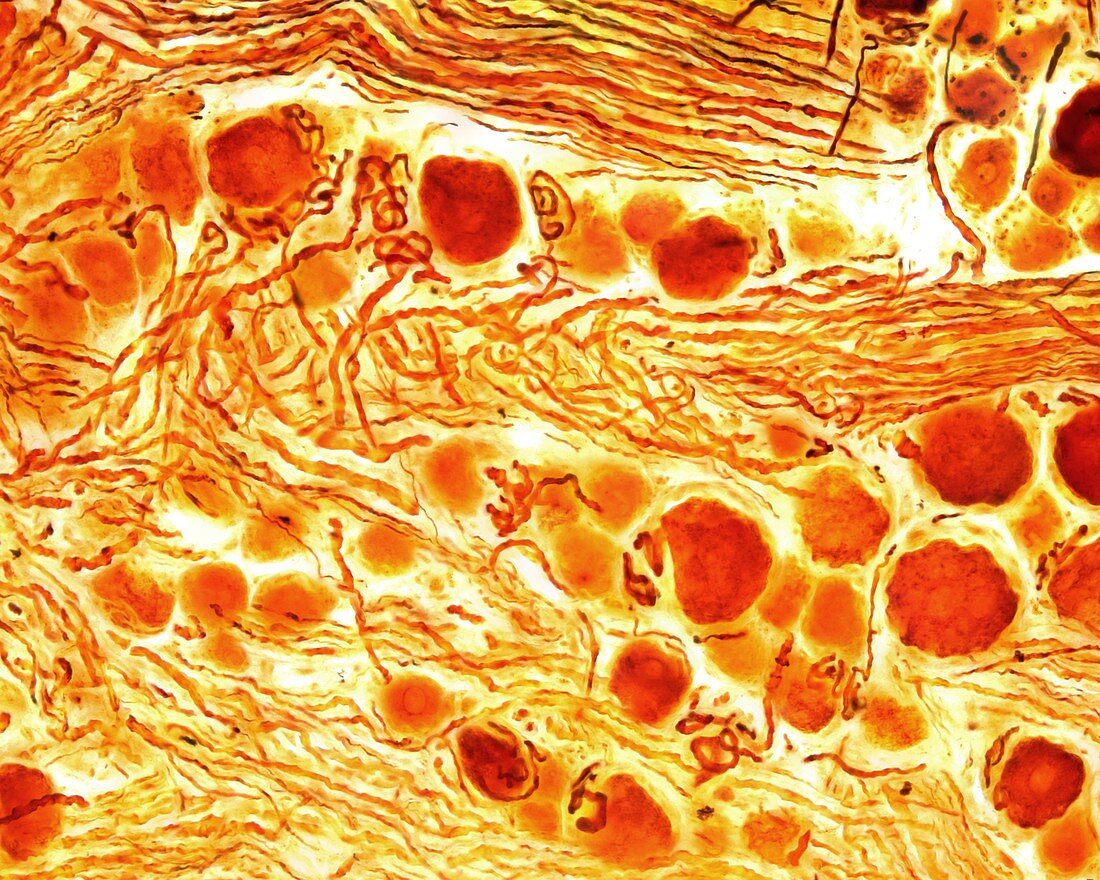 Dorsal root ganglion, light micrograph