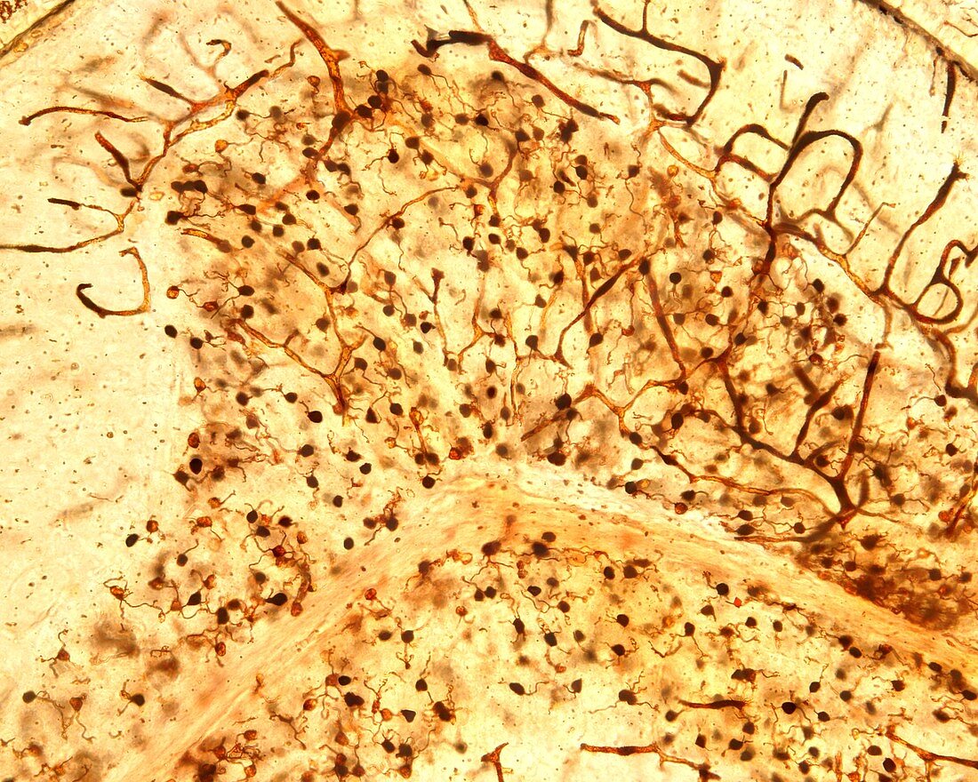 Cerebellar granule cells, light micrograph
